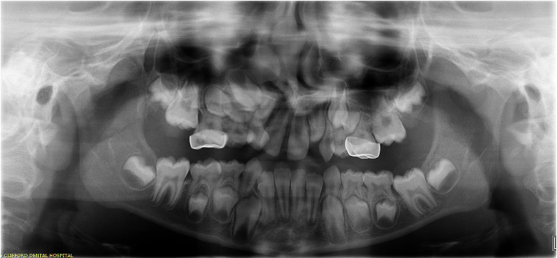 <p>comment on these PMCs</p>