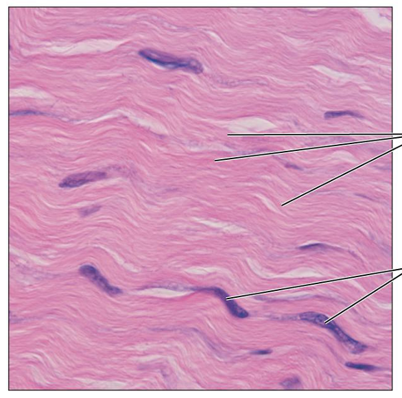 <p>What is this tissue, and where is it found?</p>
