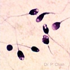 <p>Identify the sperm morphology.</p>