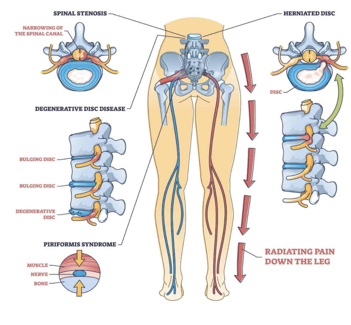 <p>Why does the PNS?</p>