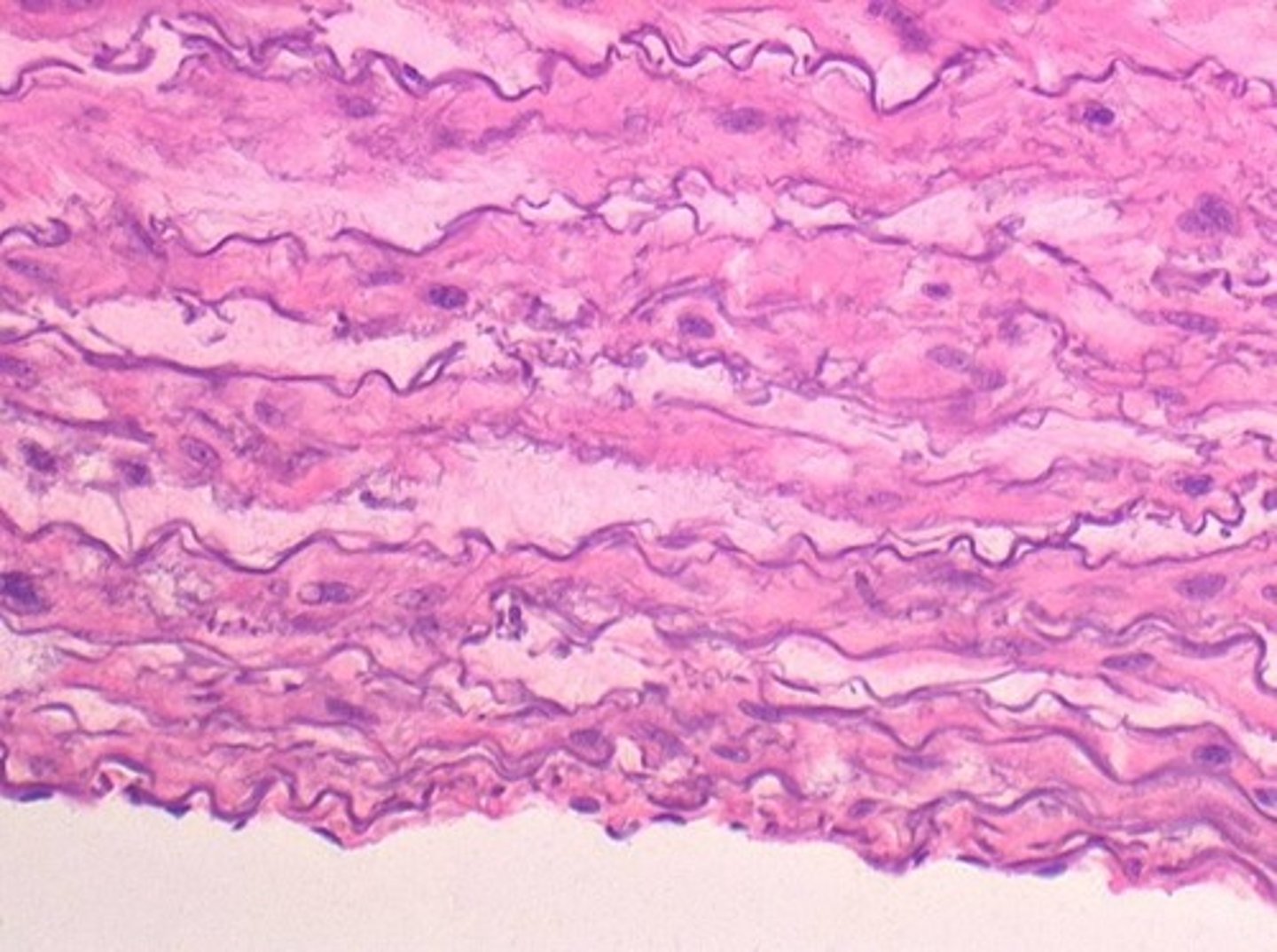 <p>Artery with thicker walls, less compliant than elastic arteries.</p>