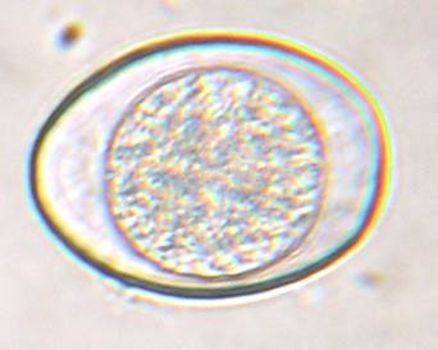 <p>ID the following parasite (cat)</p><p>30x40um</p>