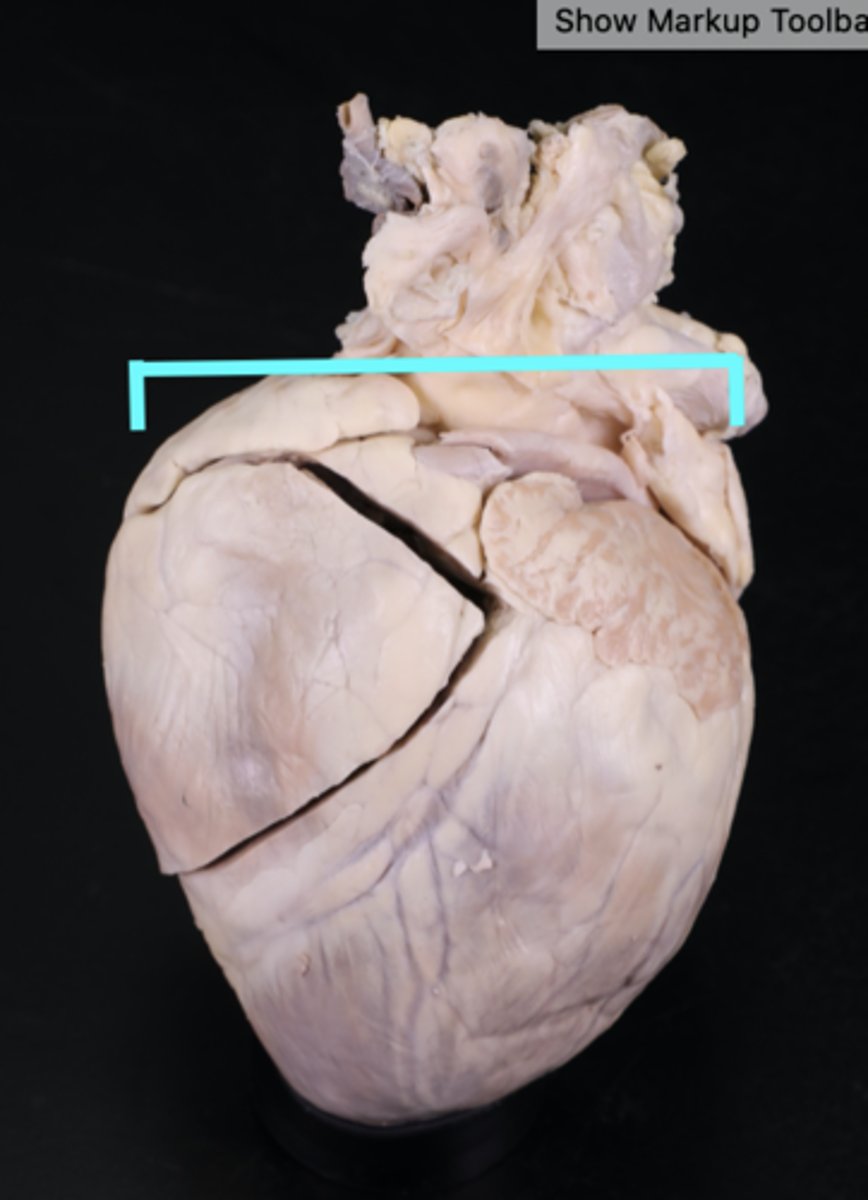 <p>The upper, broader portion of the heart where major vessels attach.</p>