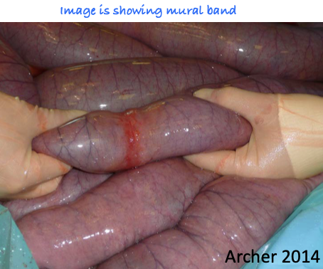 <p>1. granulomatous enteritis</p><p>2. lymphocytic-plasmacytic enteritis</p><p>3. basophilic enterocolitis</p><p>4. multisystemic eosinophilic epitheliotropic enterocolitis (MEED)</p><p>5. eosinophilic enterocolitis (idiopathic focal eosinophilic enteritis)</p><p>Great Lions Bring Majestic Energy</p>