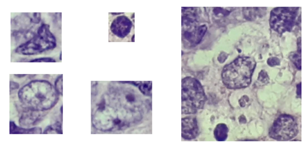 <p>Vilka är dessa celler?</p>