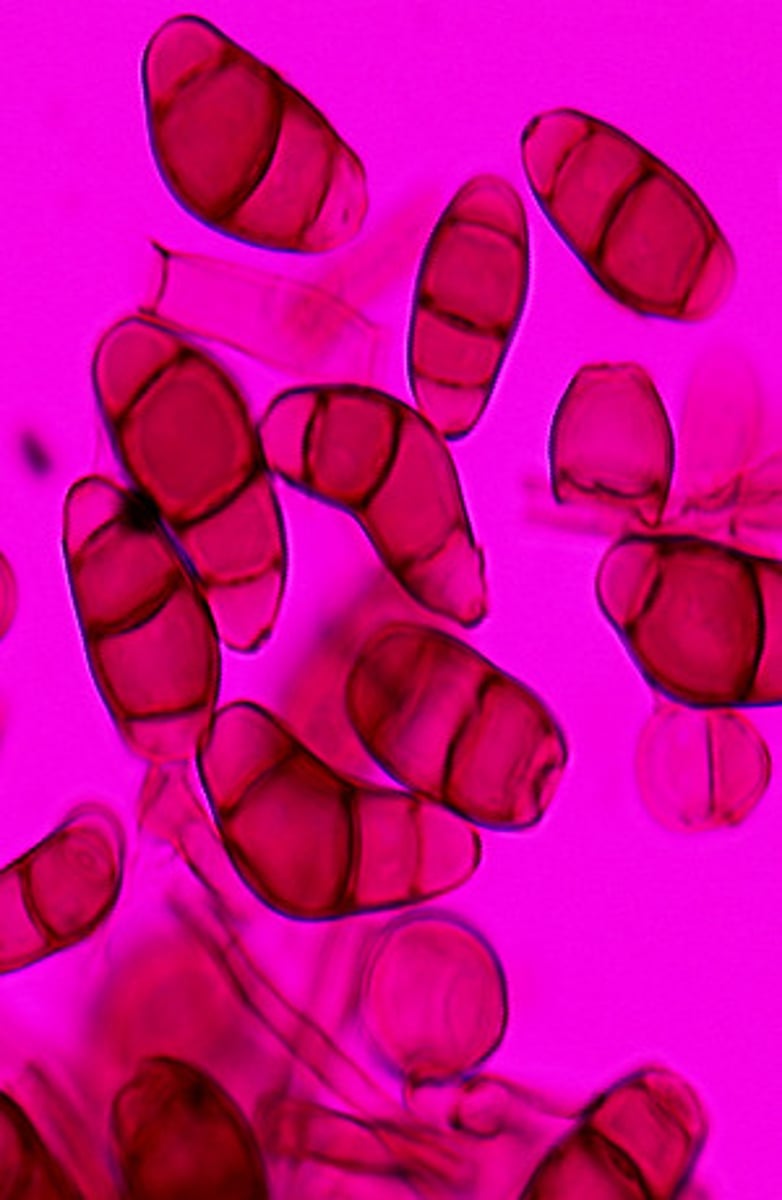 <p>Curvularia spp. are dematiaceous molds that produce curved poroconidia with a swollen central cell.</p>