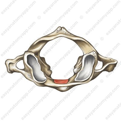 <p>Name the portion of the bone highlighted in red.</p><p>(Found on the axis).</p>