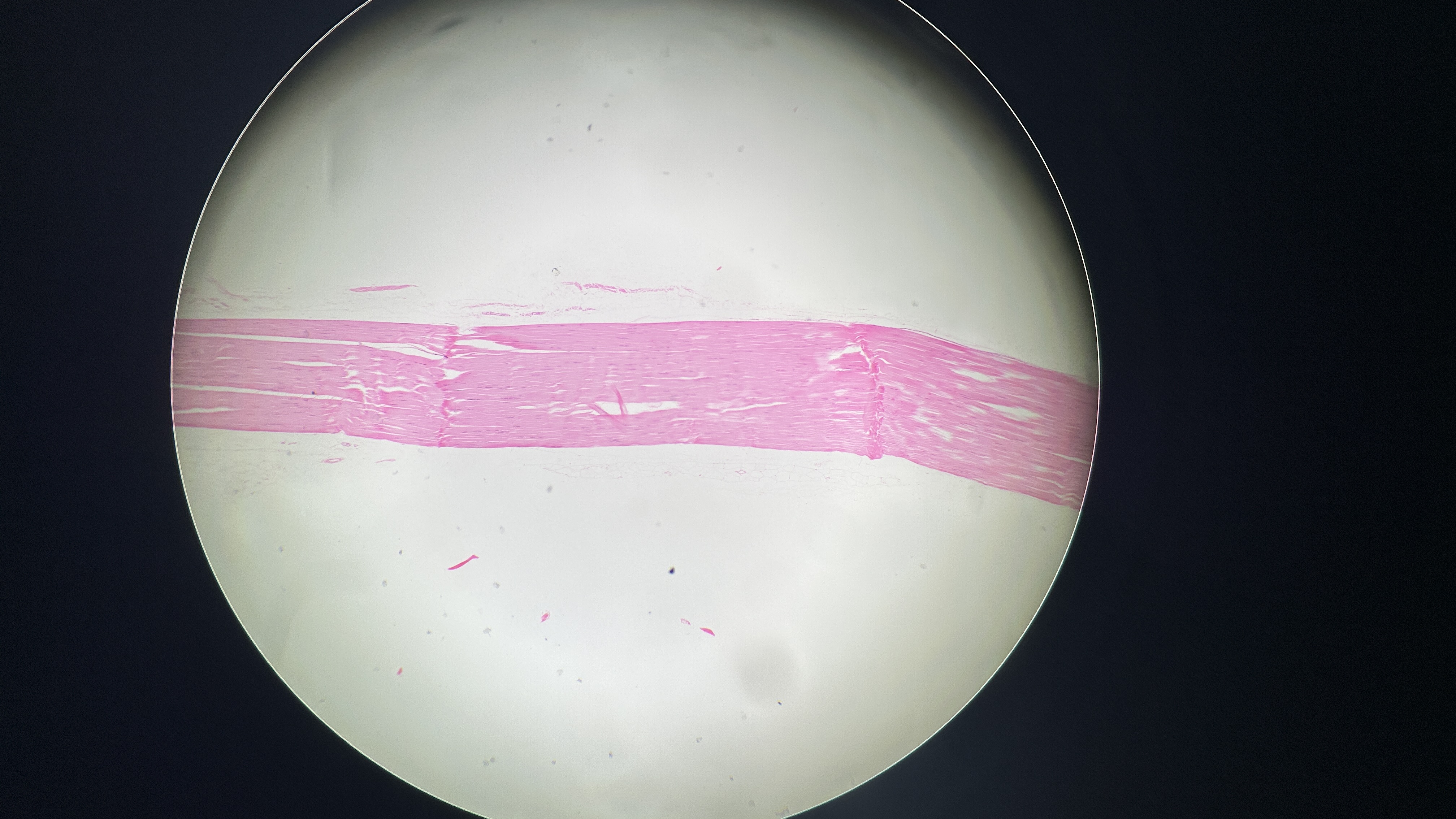 <p>What is the magnification level of the Dense Regular CT?</p>