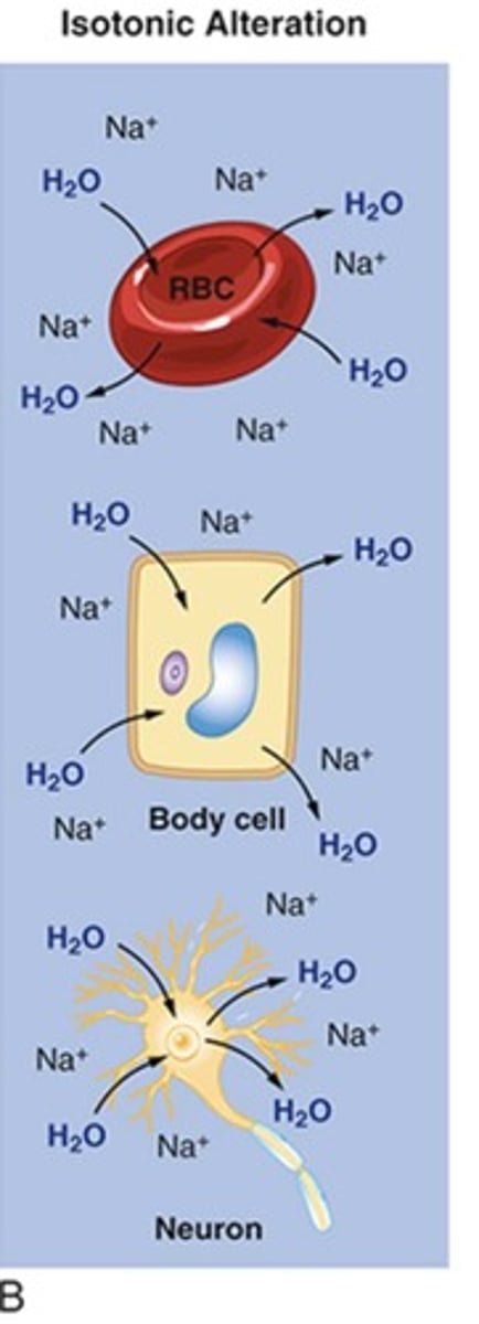 <p>H2O deficit in ECF (dehydration), most commonly caused by fluid loss or excess IV fluids</p>