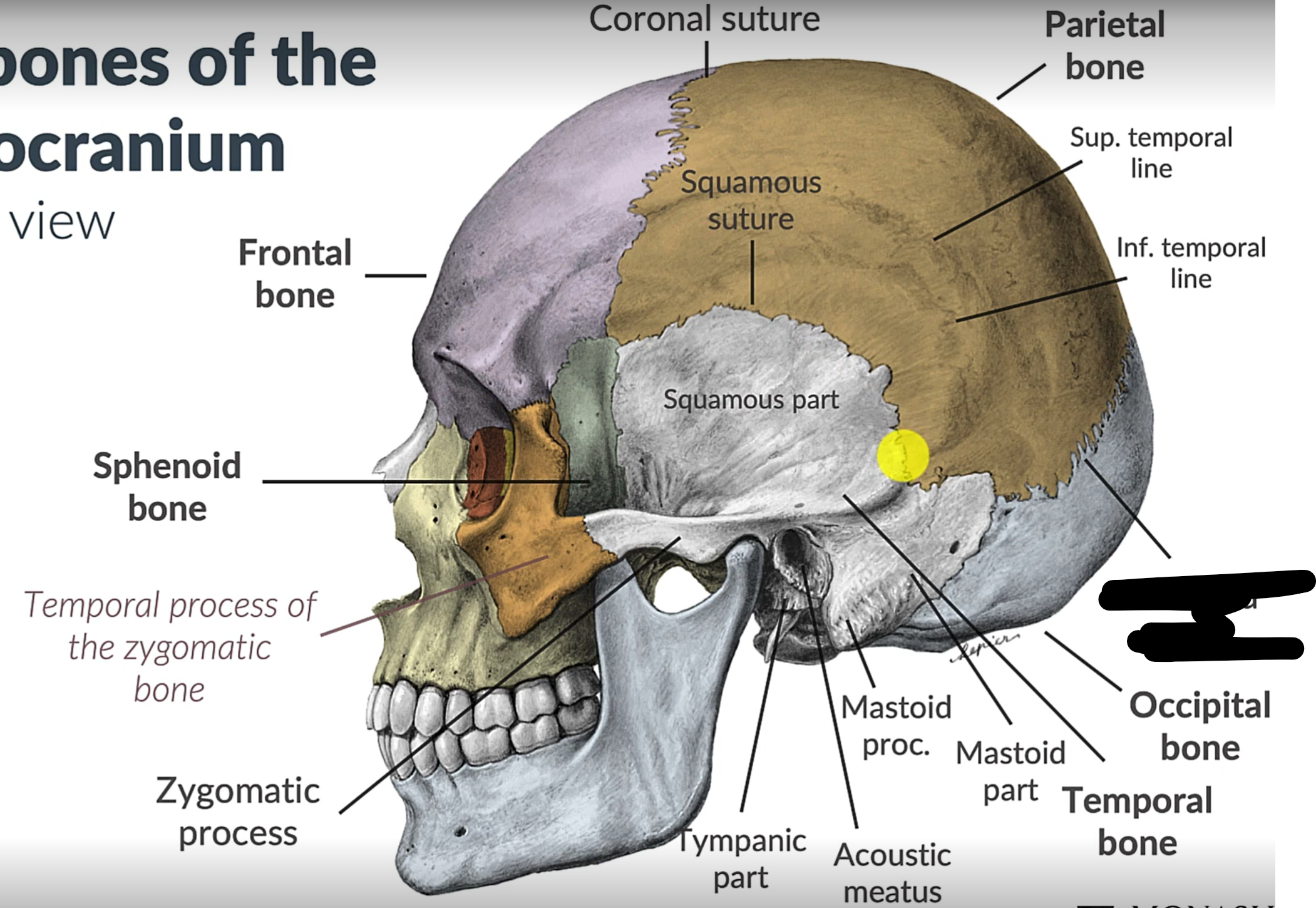 term image