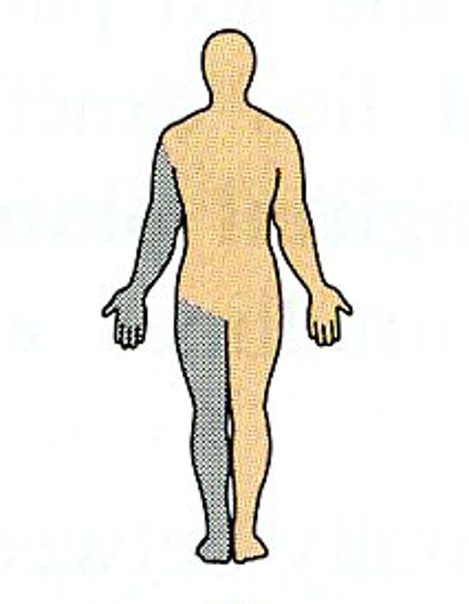 <p>on the same side of the body as that half of the nervous system</p><p>R hand is ipsilateral to the R hemisphere of the brain</p>
