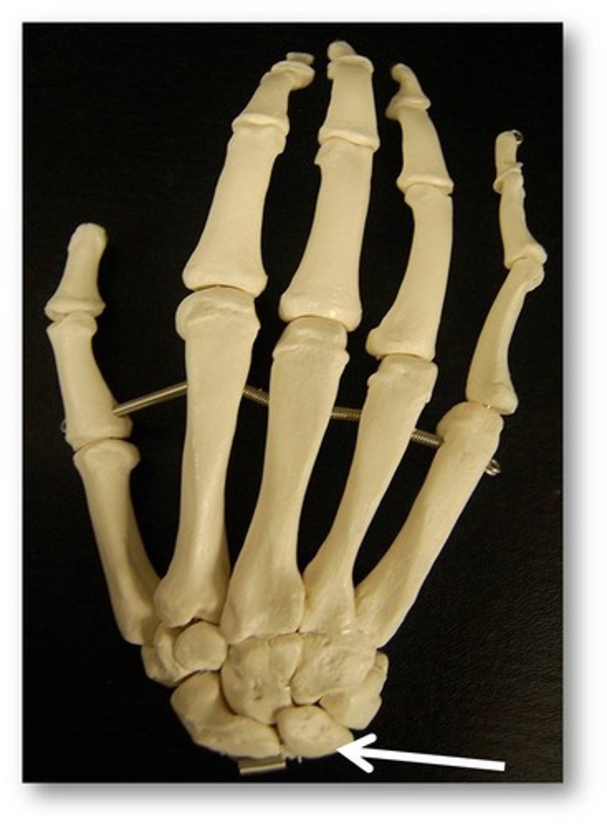 <p>one of the eight small bones that form the wrist and base of the hand; these are grouped as a proximal row consisting of (from lateral to medial) the scaphoid, lunate, triquetrum, and pisiform bones, and a distal row containing (from lateral to medial) the trapezium, trapezoid, capitate, and hamate bones</p>