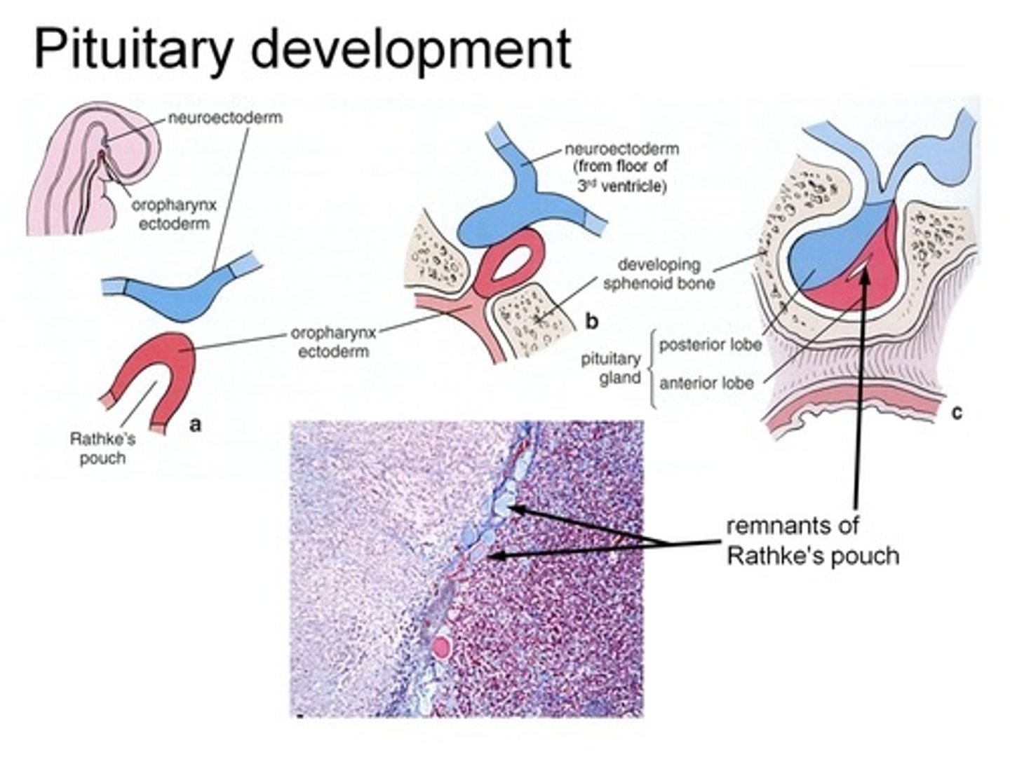 <p>embryonic origin from the Rathke's pouch</p><p>tubular invagination of pharyngeal epithelium</p><p>arises independent of the hypothalamus</p>