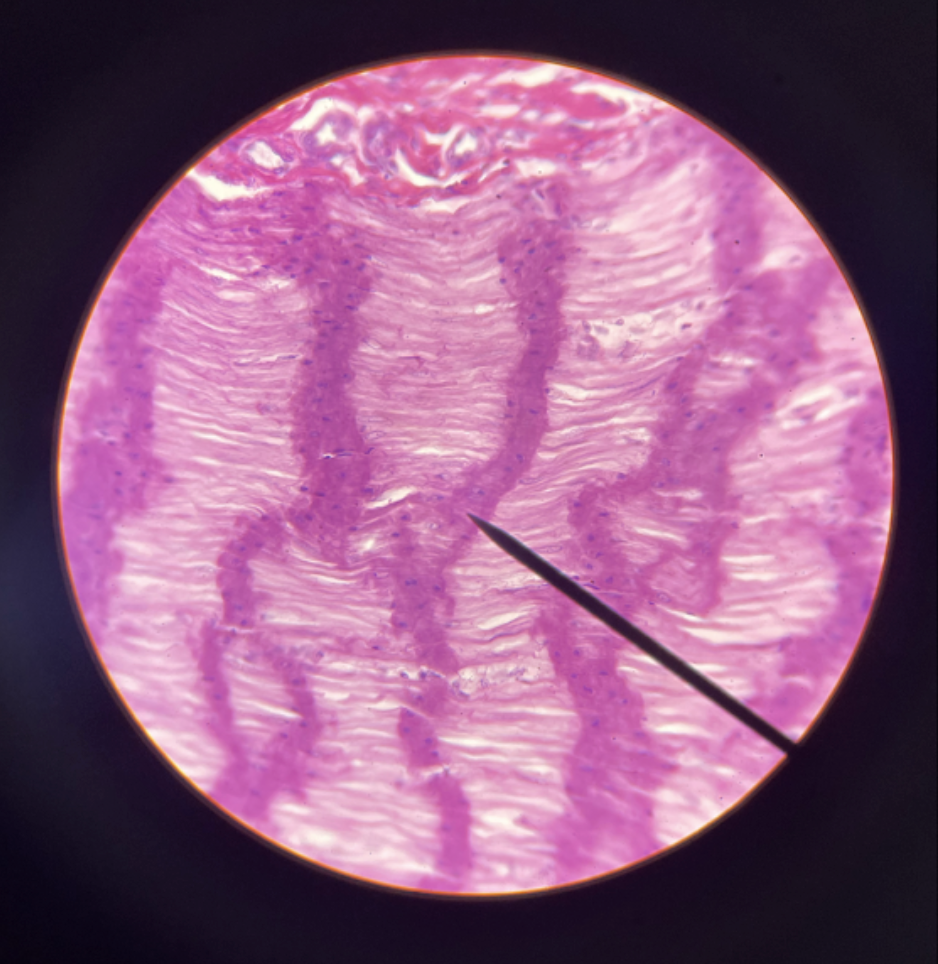 term image