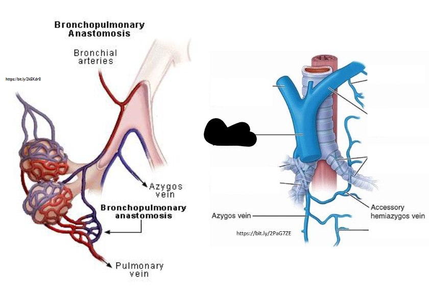 <p>What Artery is this?</p>