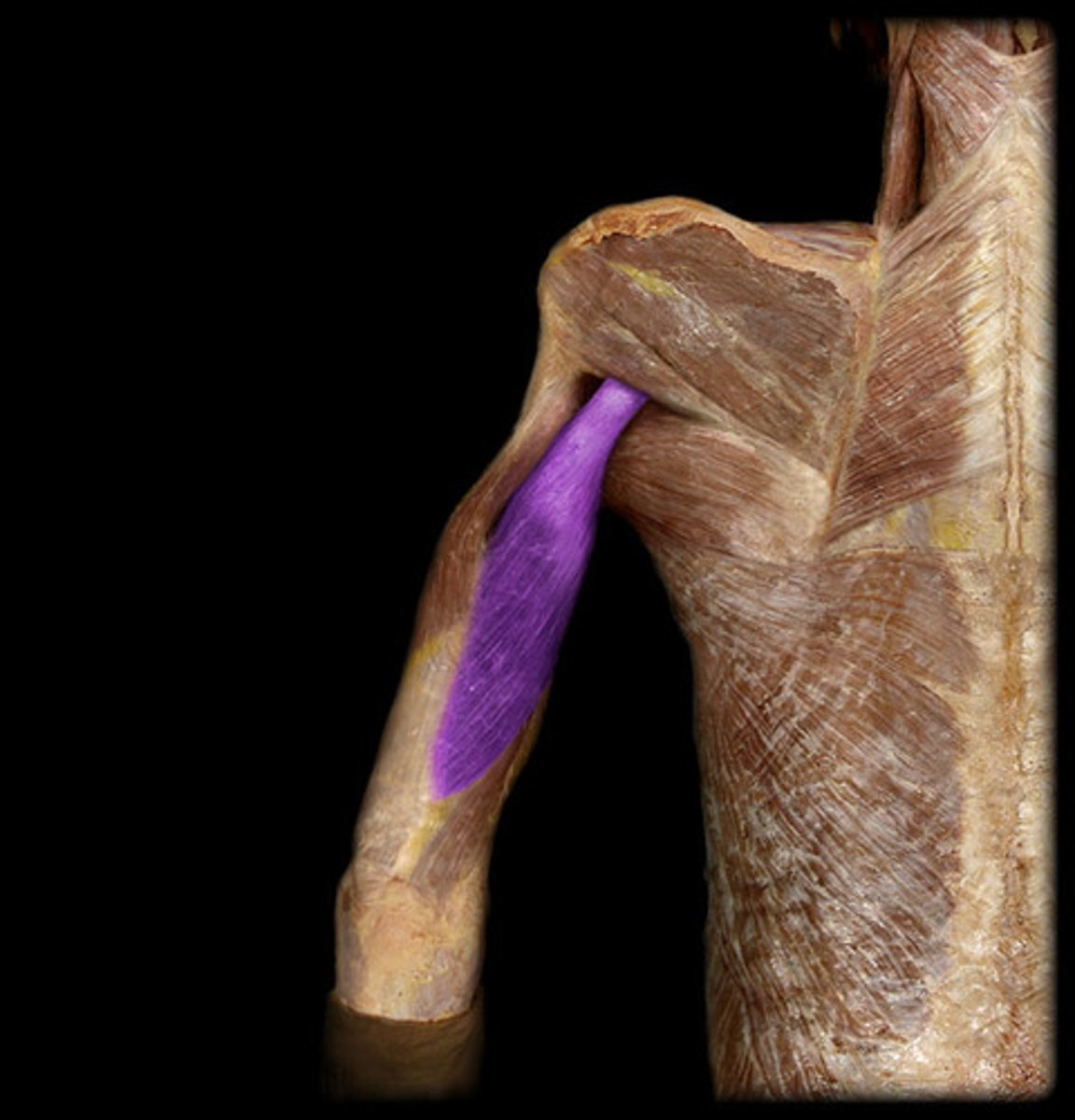 <p>-largest of 3 heads</p><p>-arises from scapula</p><p>-spindle shaped mass</p><p>-insert- olecranon process</p><p>- act together with lateral and medial head to extend the forelimb</p>