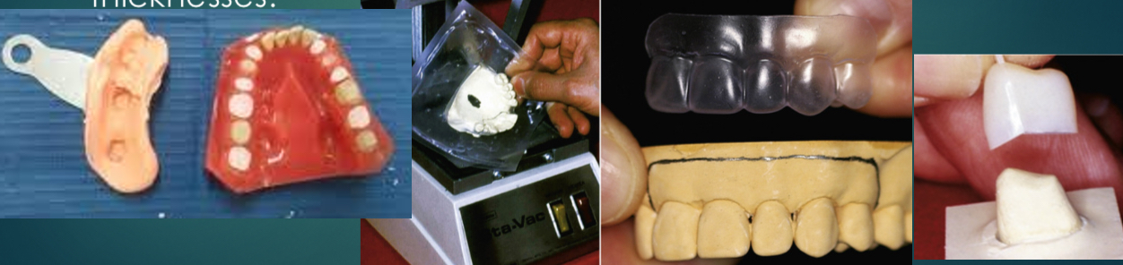 <p>Negative reproduction of either patients teeth before prop or modified diagnostic cast&nbsp;</p><p>Obtain from impression- mouldable putty popular- can trim easily for accurate reseating&nbsp;</p><p>Use thermoplastic sheets&nbsp;</p><p>Fill in with autopolymerising resin or acrylic </p>