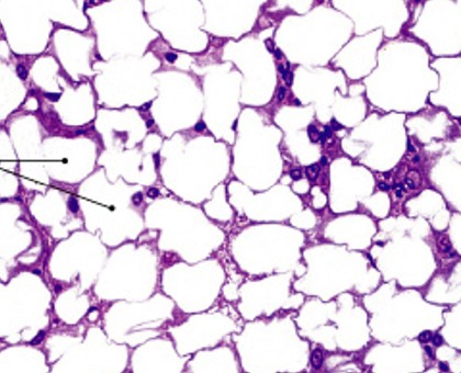 <p>Which type of connective tissue has:</p><ul><li><p>Contains many adipocytes (fat cells)</p></li><li><p>Stores fat</p></li><li><p>Absorbs shocks</p></li><li><p>Slows heat loss (insulation)</p></li></ul><p></p>