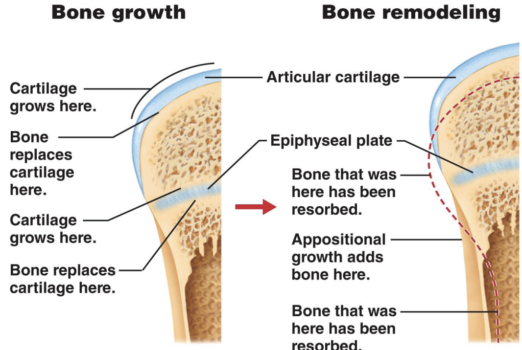 <p>Bone will adapt to the loads under which it is placed</p><ul><li><p>Bone is laid down where it’s needed and reabsorbed where it’s not needed</p></li></ul><p></p><p><strong><em><u><mark data-color="yellow" style="background-color: yellow; color: inherit;">Best to mention Appositional growth:</mark></u></em></strong></p><ul><li><p>Increased Appositional growth on the arm with greater stress</p></li><li><p>Larger cross-sectional area</p></li><li><p>More cortical bone to bear more strength</p></li><li><p>Thus, greater bone density</p></li></ul><p></p>