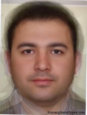 <p>Identify this Phenotype</p>
