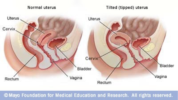 <p><span>a backward tilting or turning of an organ or body part</span></p>