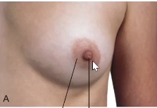 <p>What is the middle of the breast known as </p>