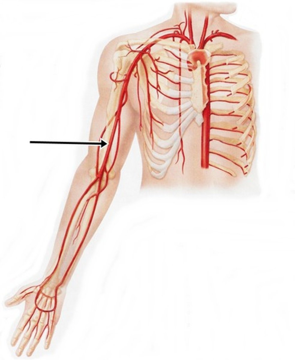 <p>subclavian aa</p><p>axillary aa</p><p>brachial aa</p><p>-radial aa</p><p>-ulnar aa</p><p>-palmar arches</p><p>--superficial and deep aa</p>