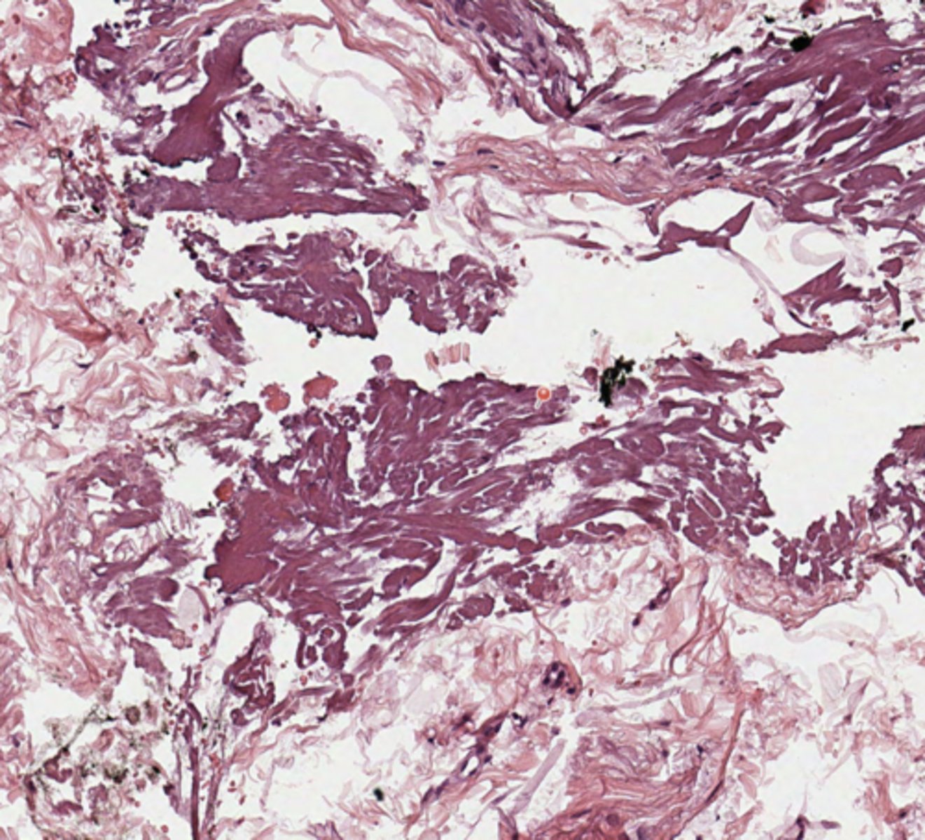 <p>Breast</p>