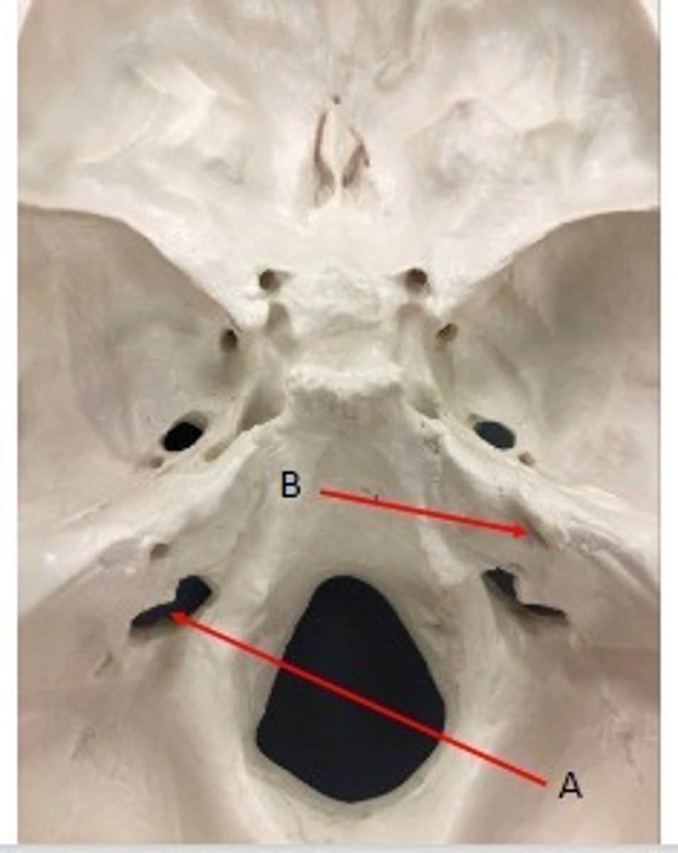 <p>What category of bone is it? What bone is it? Label the structures.</p>