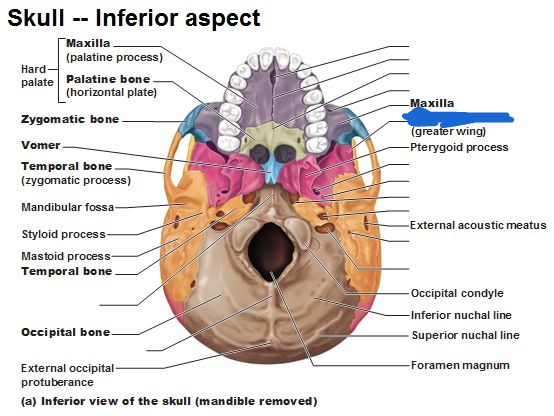 <p>sphenoid bone (inferior view)</p>