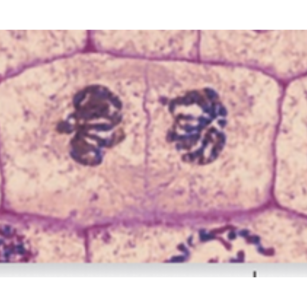 <p>What kind of cell is shown? Name the phase that it is experiencing.</p>