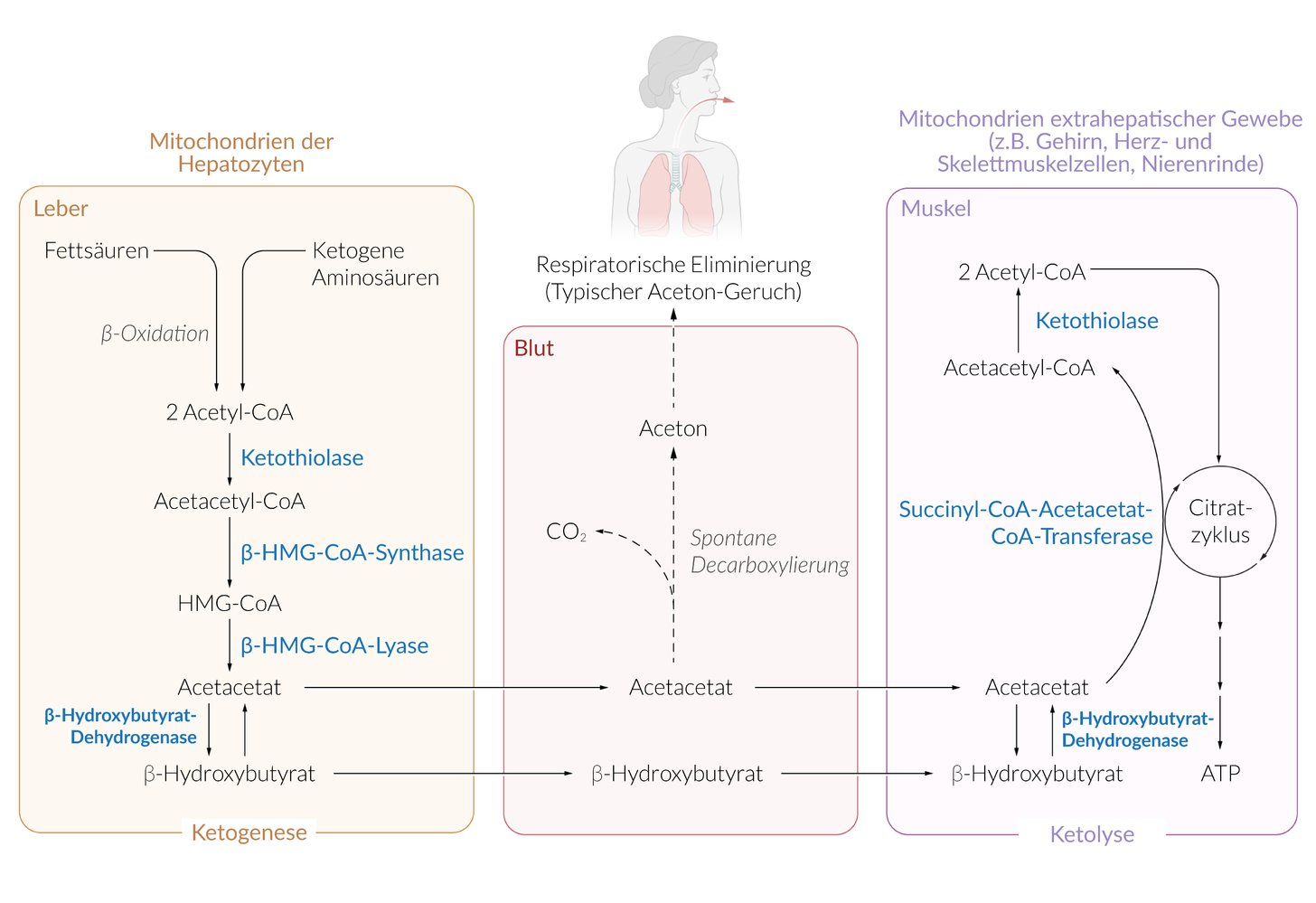 <p>A. 3-Ketoacyl-CoA transferase</p>