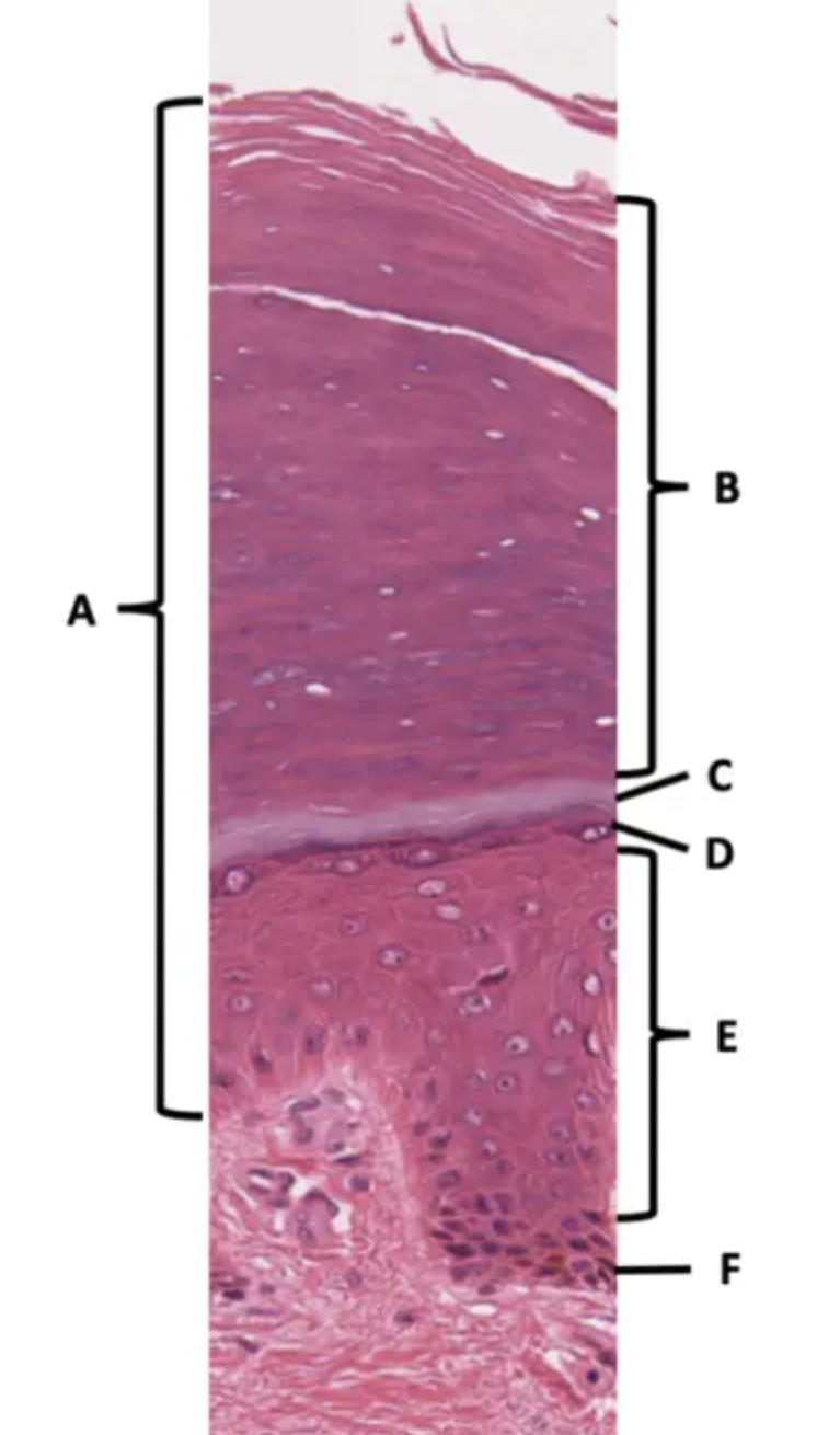 Which is the Epidermis of thick skin: