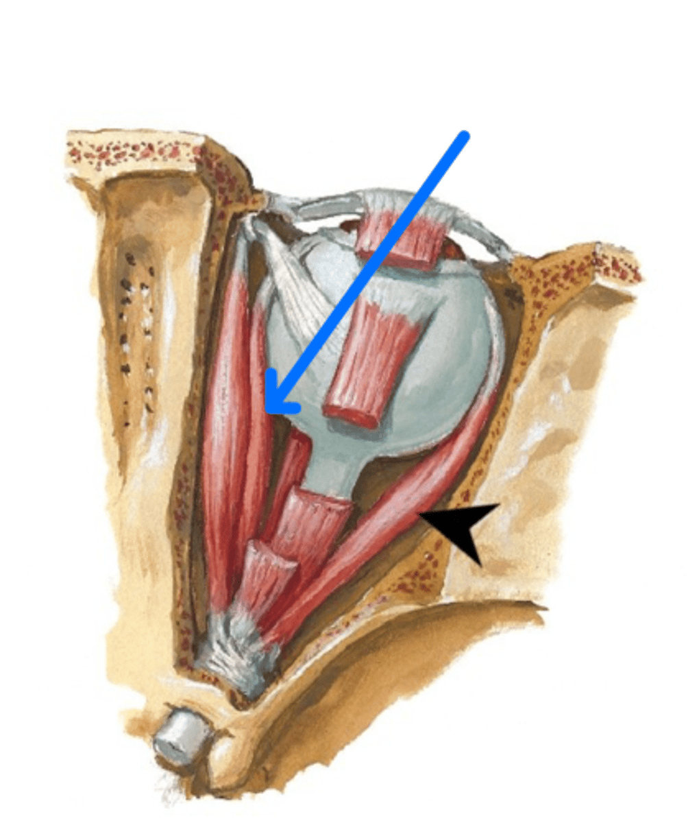 <p>What is the blue arrow pointing to?</p>