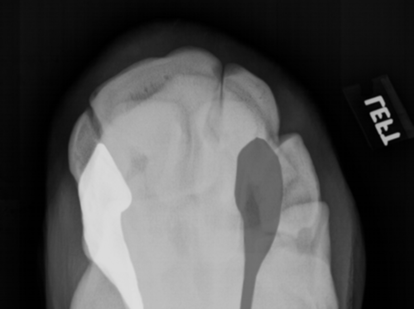 <p>What bone is highlighted in white? Gray?</p>