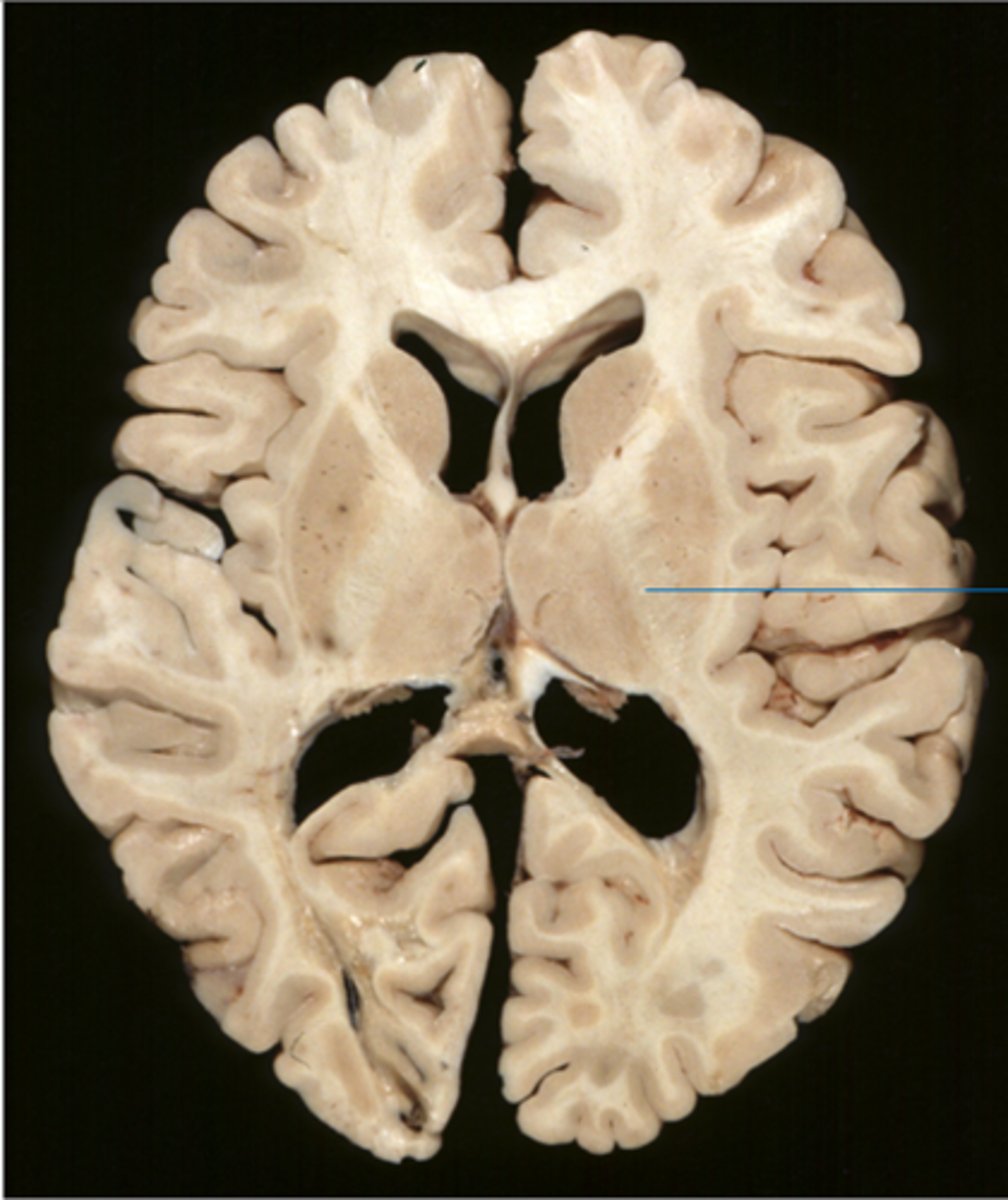 <ul><li><p><strong>Corticospinal motor tract</strong> to UE, trunk, LE (rostral); (FAL)</p></li><li><p><strong>Somatosensory pathways</strong> from UE, trunk, LE (caudal) (fal)</p></li></ul>