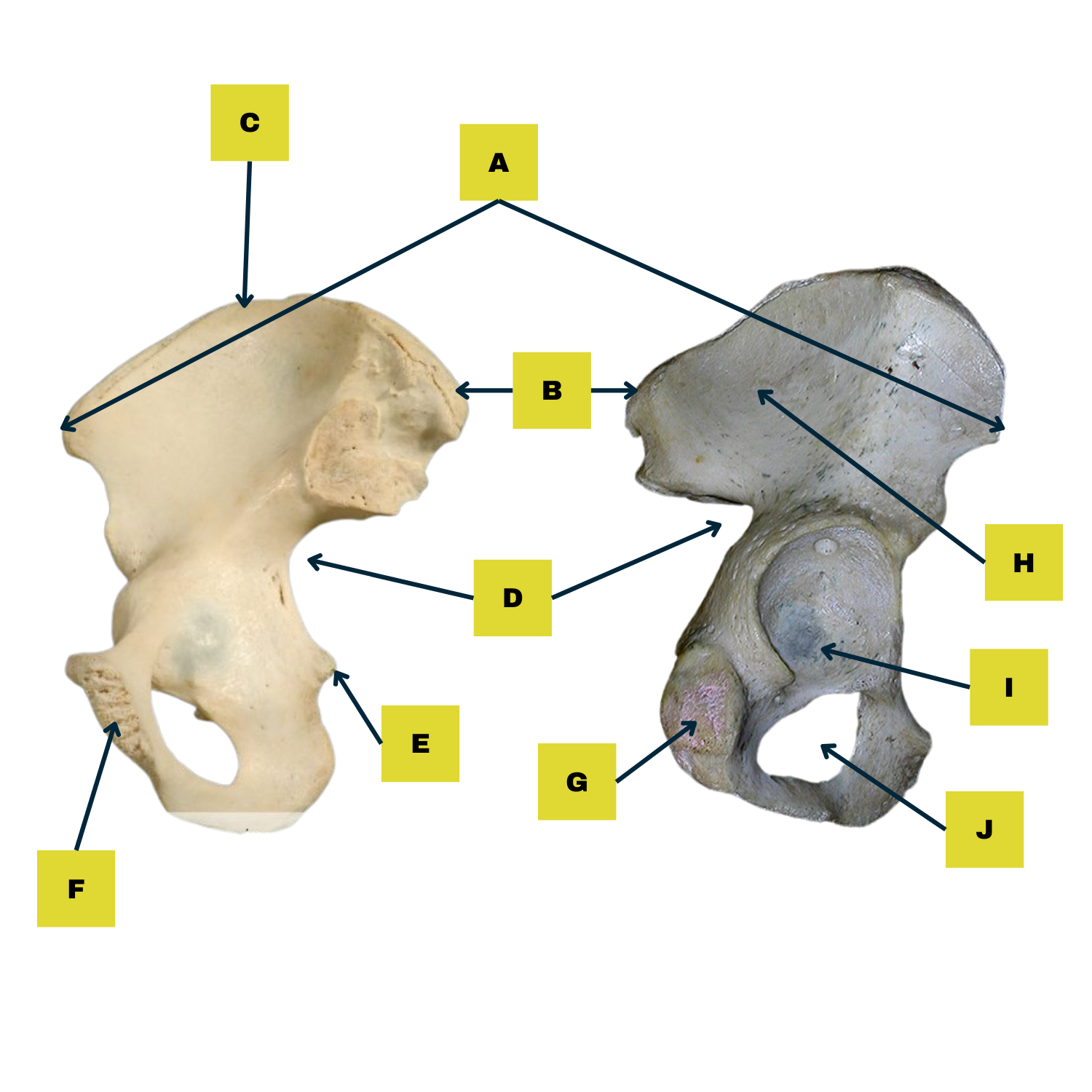 <p>Label F (Where pubic symphysis is)</p>