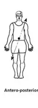 <p>front-to-back</p>