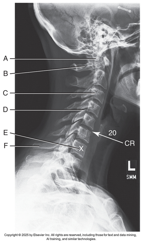 <p>What anatomical structure is letter C?</p>