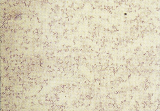 <p>gram negative rod, comma-shaped. growth on simple culture/agar; media specific for this is also available. oxidase positive (enterics are negative). lactose negative</p>