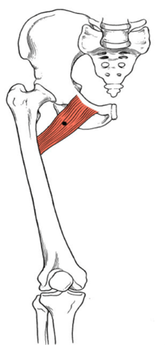 <p>Superior ramus of the pubis</p>