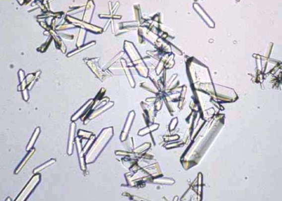 <p>Name the crystal </p>