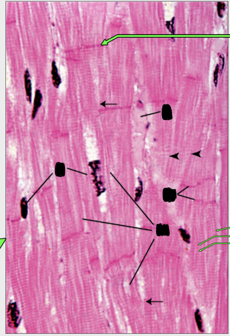 <p>can you identify;</p><ul><li><p>cardiac muscle cells </p></li><li><p>nucleus </p></li><li><p>intercalated disks </p></li><li><p>striations showing evidence of myofibrils and sarcomeres </p></li></ul><p></p>