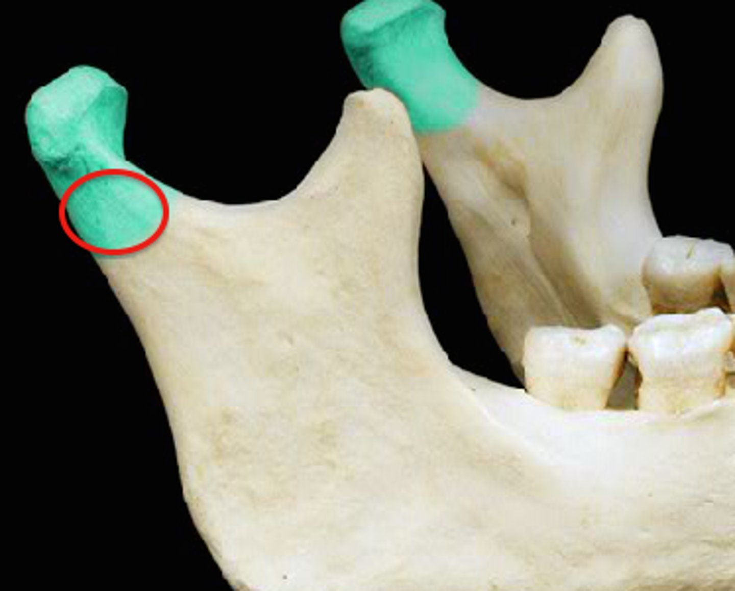<p>What is the constricted area directly below the condyle of the condyloid process?</p>