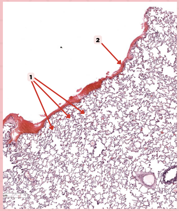 <p>The surface related to the pleural cavity is in line with what type of epithelium?</p>