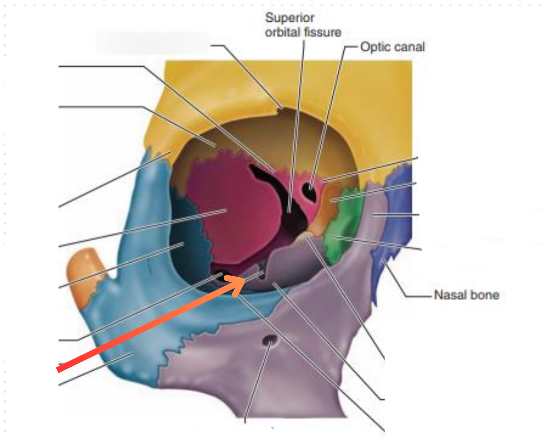<p><strong>Infraorbital foramen</strong></p><p>Transmits the infraorbital vessels and nerve</p>
