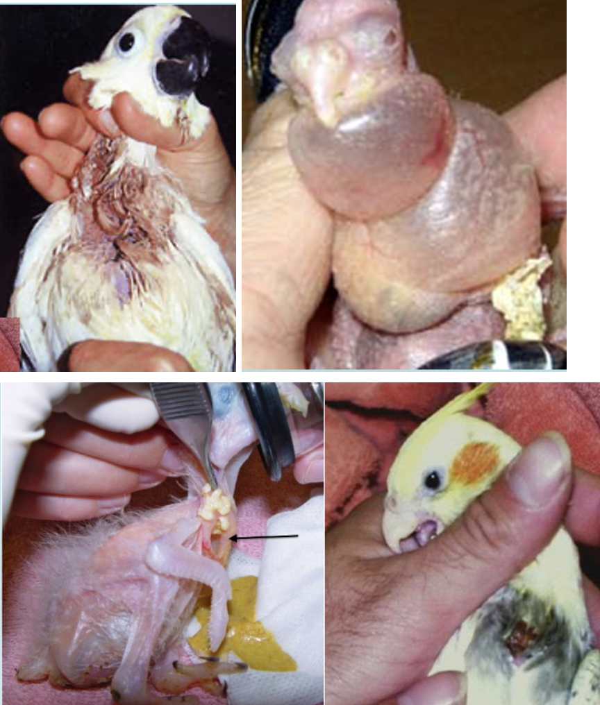 <p>Incredibly common, crop burns are caused by feeding formula that is too HOT.</p><ul><li><p>Due to excessive feathers, caretakers often do not realize the damage until days later, when the burn inside the crop fistulates (forming an opening to the outside)</p></li><li><p>In other words, the crop is burned clear through to the outside of the bird&apos;s body.</p></li><li><p>This condition will lead to serious bacterial and fungal complications.</p></li><li><p>Mostly Veterinarians will put the bird on antifungal and antibiotic and will suture the crop if needed.</p></li></ul>