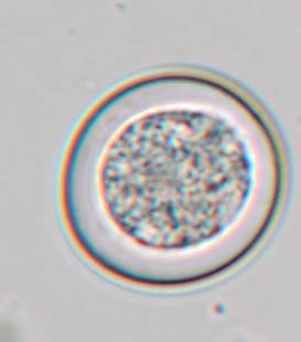 <p>This structure was found on the fecal flotation of a 19 week old puppy with diarrhea. It measures approximately 25 um. What is it?</p>