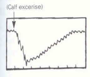 <p>Identify this image. </p>