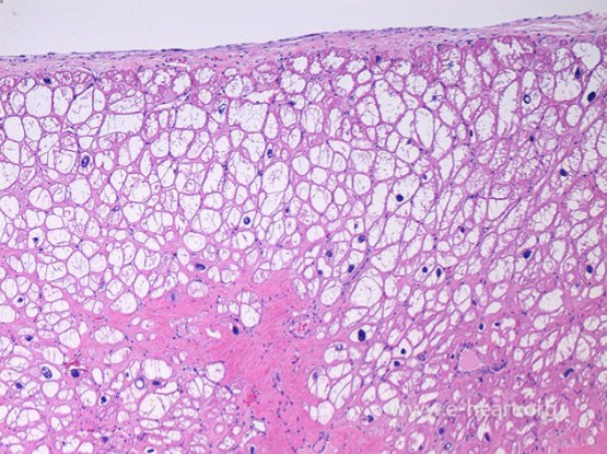 <p>This tissue has changed due to injury. Why type of change has occurred</p>